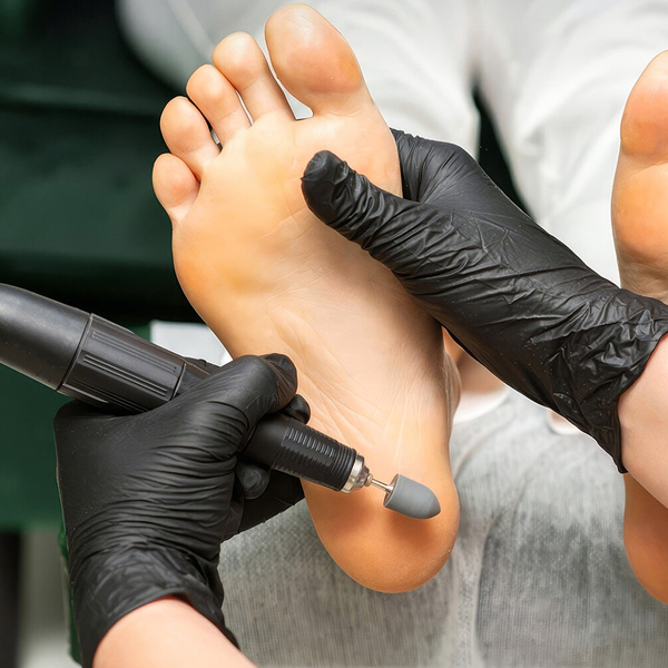 Preventative & Ongoing Foot Care